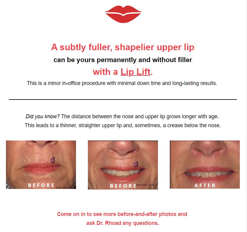 Instagram post by Dr. Deirdre M. Rhoad: Perk up your upper lip with a Lip Lift, a minor in-office procedure with very little down time. Find out how today! Schedule your free consu…