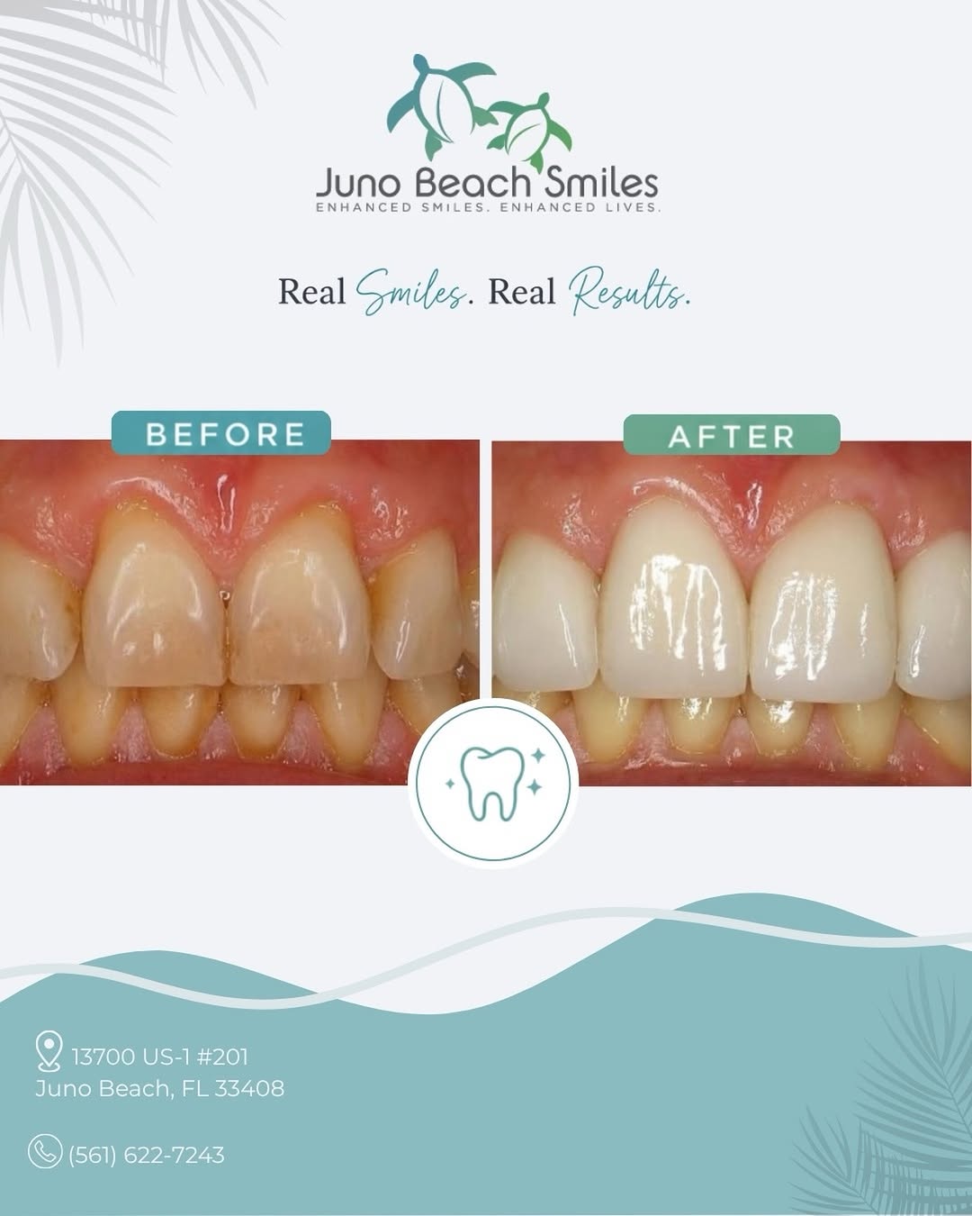 Instagram post by Dr. Duane E. Keuning, D: ✨ A smile transformation can change more than just a smile it can change the way you feel about yourself! ✨ We’re proud to help our patients…