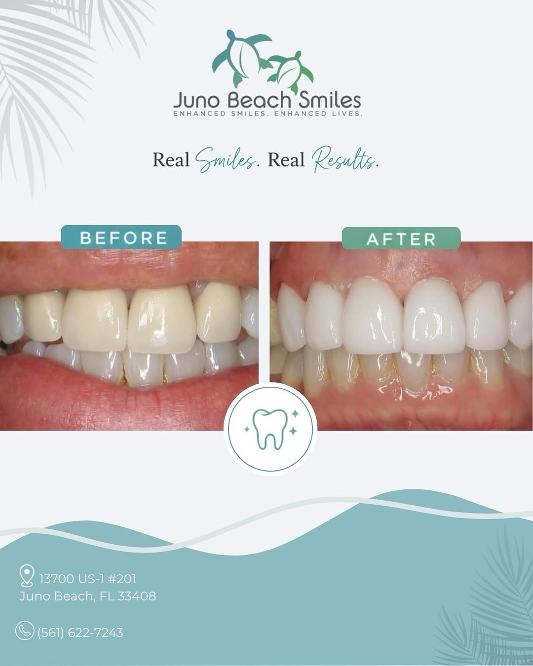 Instagram post by Dr. Duane E. Keuning, D: We love creating results that make our patients smile a little bigger. 😁
