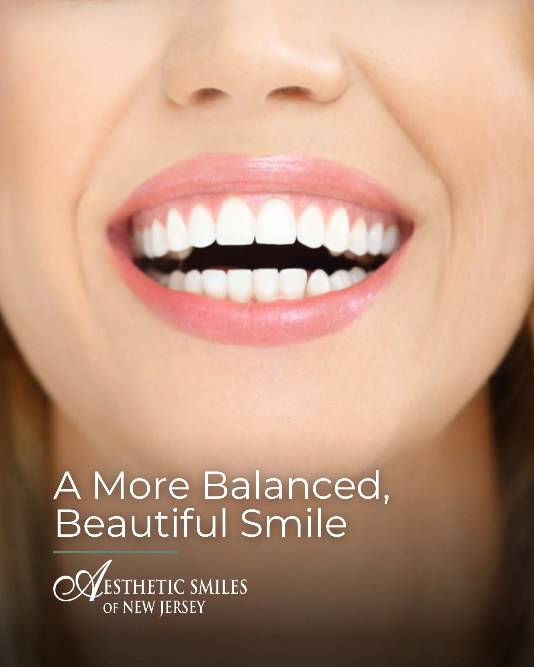 Instagram post by Dr. Edward A. Romano, DDS: Gum contouring is one of those treatments most people don’t know exists, until they need it. If your gumline looks uneven or shows too much …
