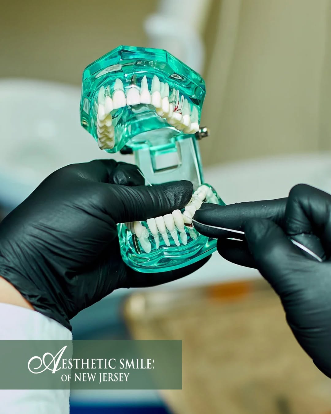 Instagram post by Dr. Edward A. Romano, DDS: A missing tooth doesn’t just affect how you look, it changes how you chew, how you speak, how you feel walking into a room. Dental implants …