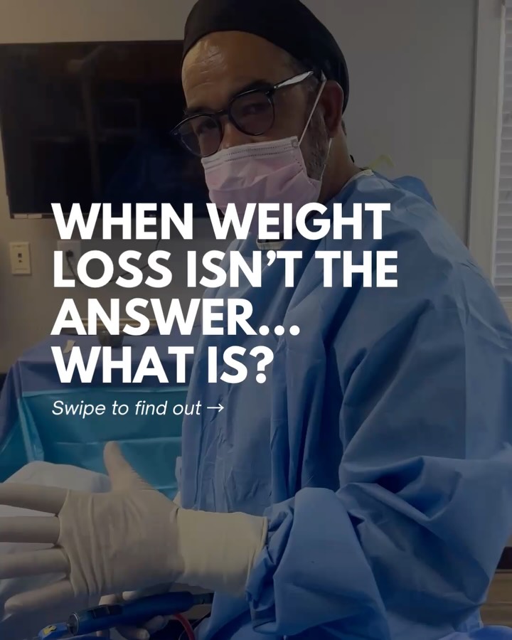 Instagram post by Dr. Edward E. Dickerson, IV: Front, side, and every angle in between 👀 Wondering why a tummy tuck and liposuction are sometimes combined? These before and after images,…