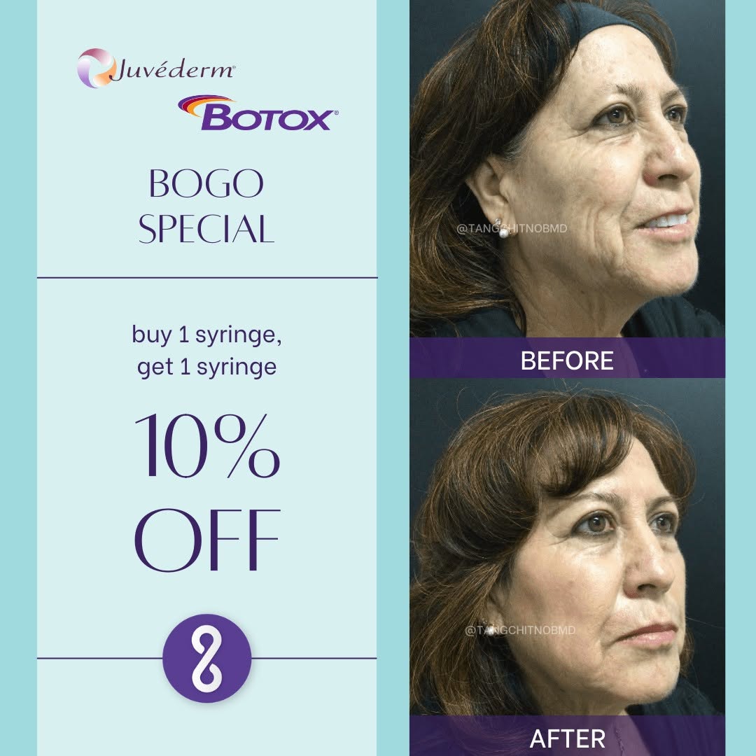 Instagram post by Dr. Edward Tangchitnob: May is our month of gratitude for our incredible patients! Treat yourself to rejuvenation with JUVÉDERM® or BOTOX®: buy one syringe and get …