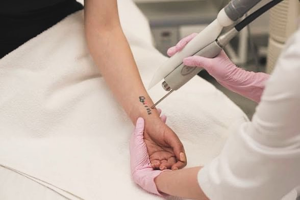 Instagram post by Dr. Elliot M. Heller: Regret a tattoo?💉 You’re not alone. Laser tattoo removal can fade or fully remove ink over time👨🏻⚕️ it does take multiple sessions and p…