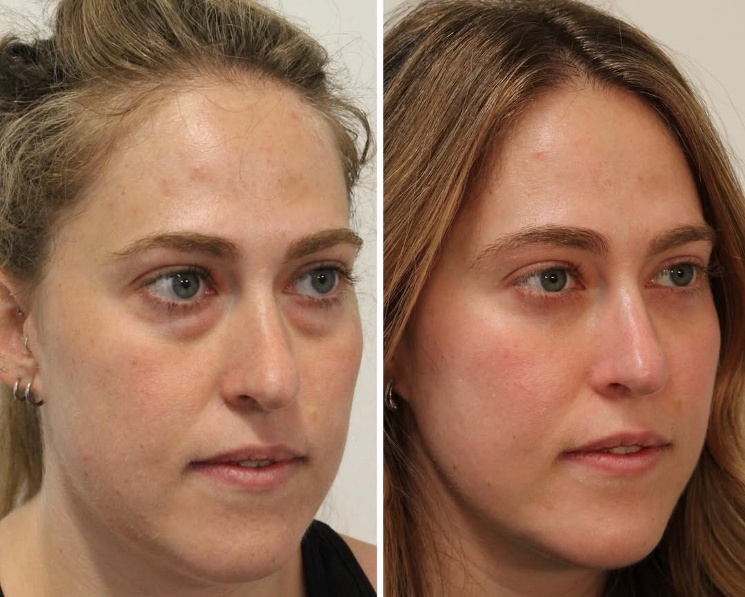 Instagram post by Dr. Emily M. Bratton: On the other hand…here’s my beautiful patient who is in her 30s who told me “she’s happy she finally looks her age! “ Scroll through to see …