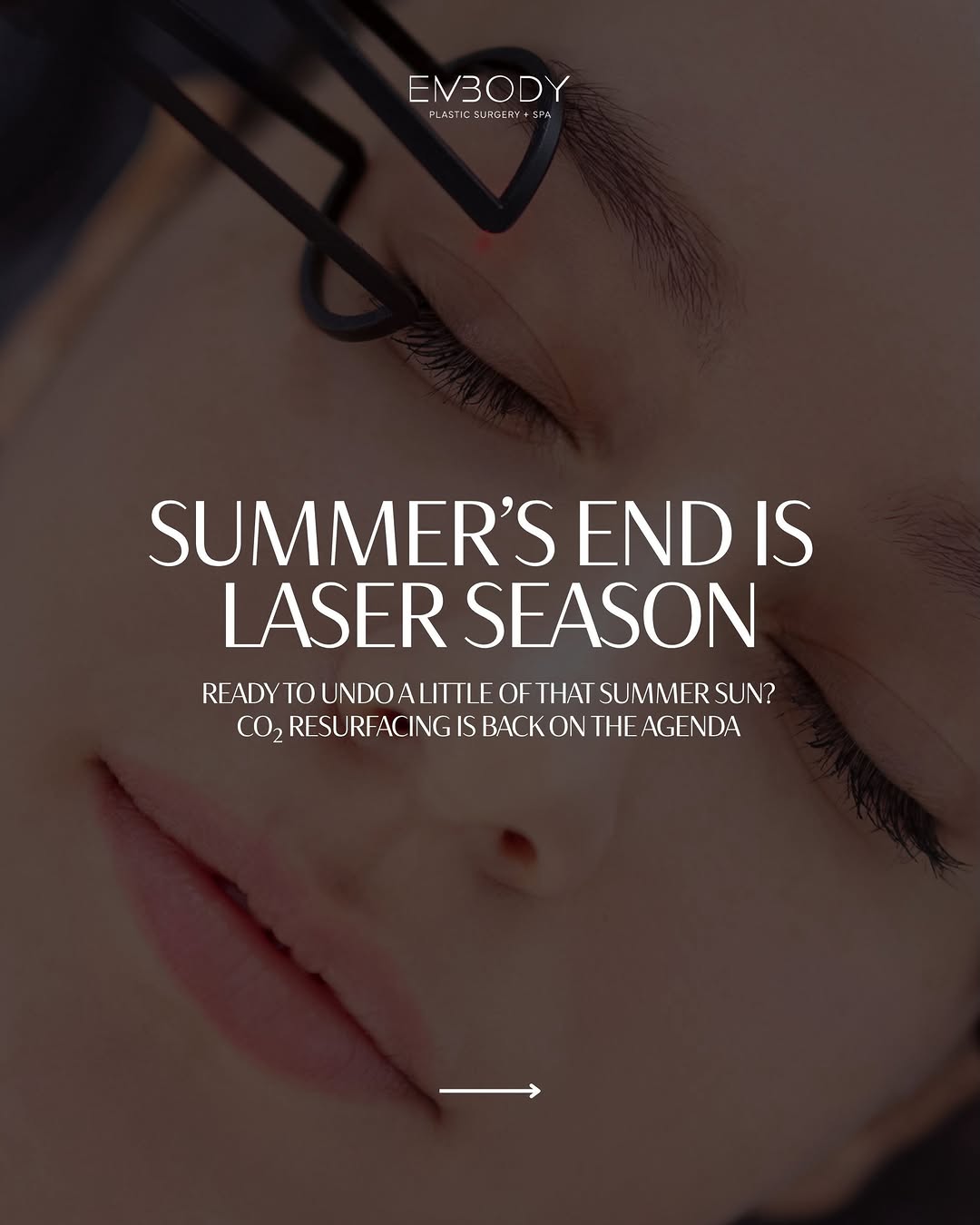 Instagram post by Dr. Erika Sato: After months of sunshine, heat, and time outdoors, fall is a great time to shift the focus back to your skin. At Embody, we use Tetra PRO CO…