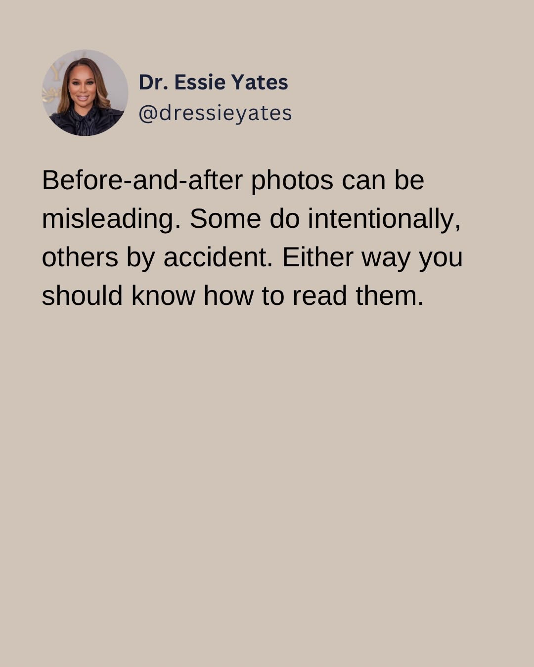 Instagram post by Dr. Essie Kueberuwa Yates: Dr. Yates gives her tips on how to spot good vs misleading before and afters.