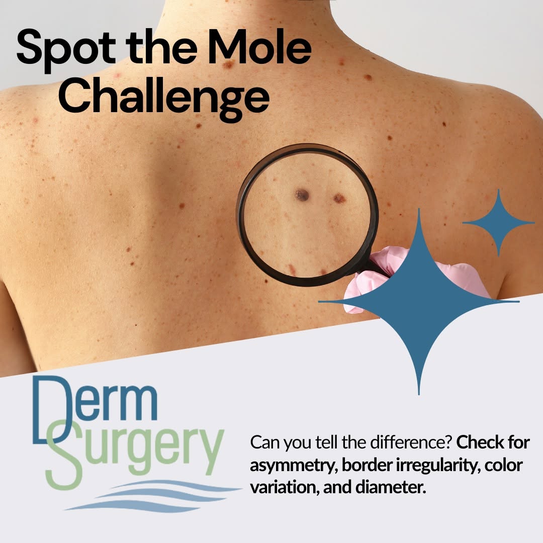 Instagram post by Dr. Esta Kronberg: 🧐 Can you spot the warning signs? Early detection is key. Schedule your total skin exam today and stay ahead of skin issues! 📞 713-791-996…