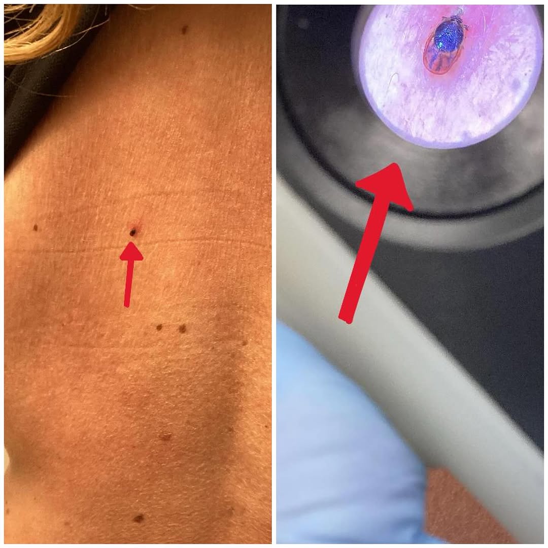 Instagram post by Dr. Estee Williams: 🧴☀️ Skin Check + Tick Check = Summer Smart! 🐜🌿 As the weather warms up, it’s the perfect time to enjoy the outdoors—but don’t forget to c…
