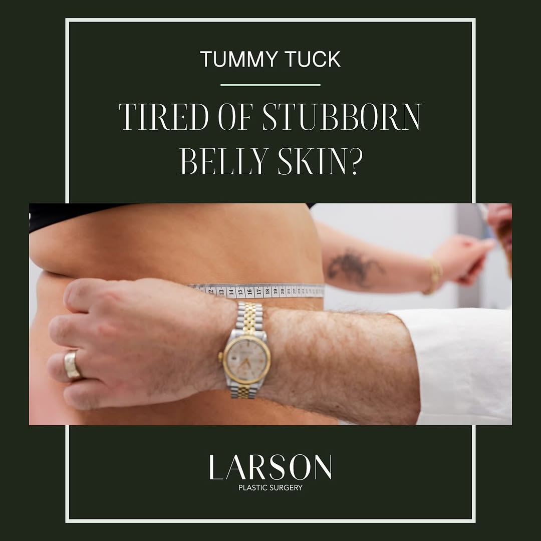 Instagram post by Dr. Ethan E. Larson: Stubborn fat doesn’t have to be permanent. Liposuction precisely removes unwanted fat deposits, sculpting a smoother, more defined shape. Dr…