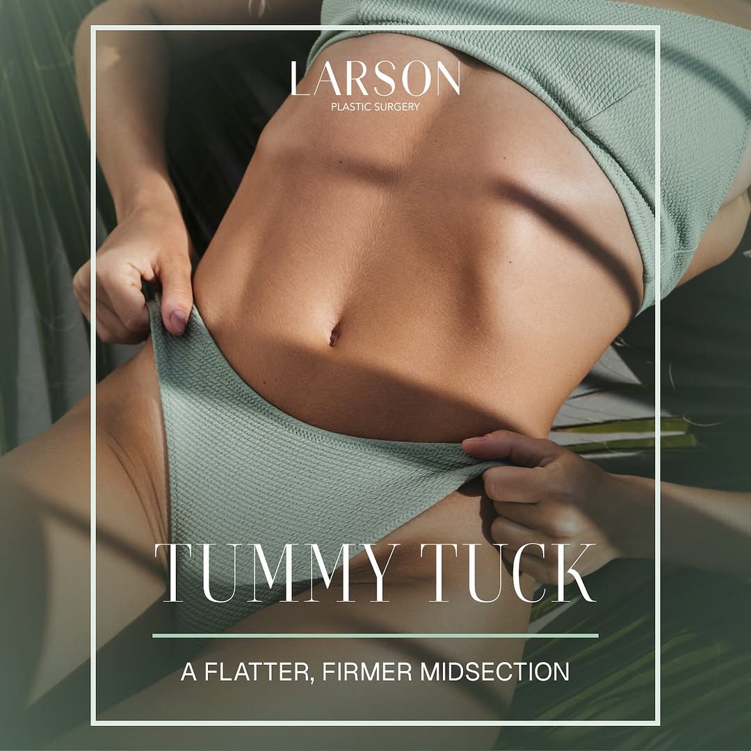 Instagram post by Dr. Ethan E. Larson: Excess skin and weakened muscles can make it hard to achieve a toned abdomen. A tummy tuck tightens, smooths, and reshapes your core for las…