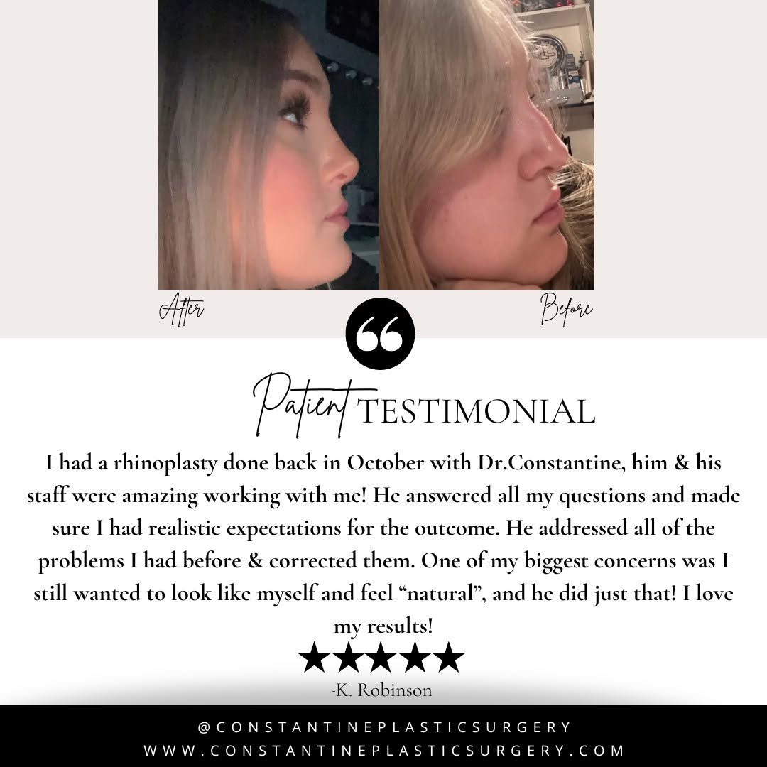 Instagram post by Dr. Fadi Constantine: ✨Testimonial Thursday ✨ We love hearing positive feedback from our patients! Thank you for allowing us to be a part of your journey to impro…