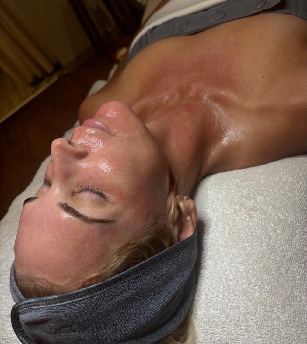 Instagram post by Dr. Farah T. Sultan: That post-microneedling glow our clients 💕 LOVE. Sydney, our licensed esthetician at Vitalogy Wellness & Medical Spa, finished this treatme…