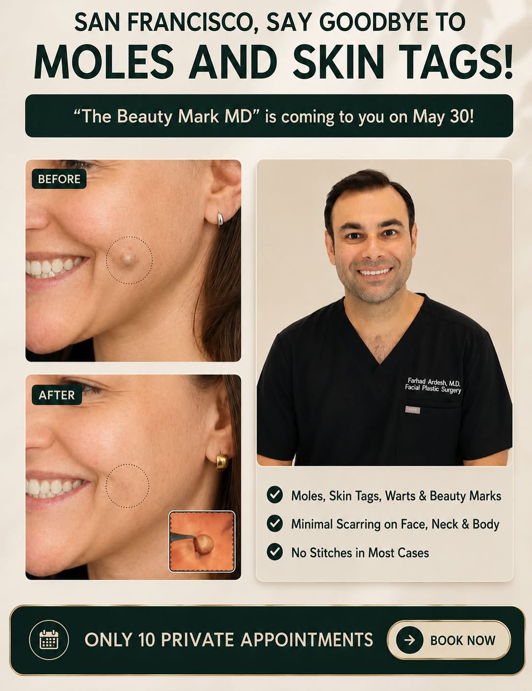 Instagram post by Dr. Farhad Ardesh: 📩 DM us to book your free consultation today. Dr. Ardesh is coming to San Francisco on May 30 for a limited number of private mole & skin t…