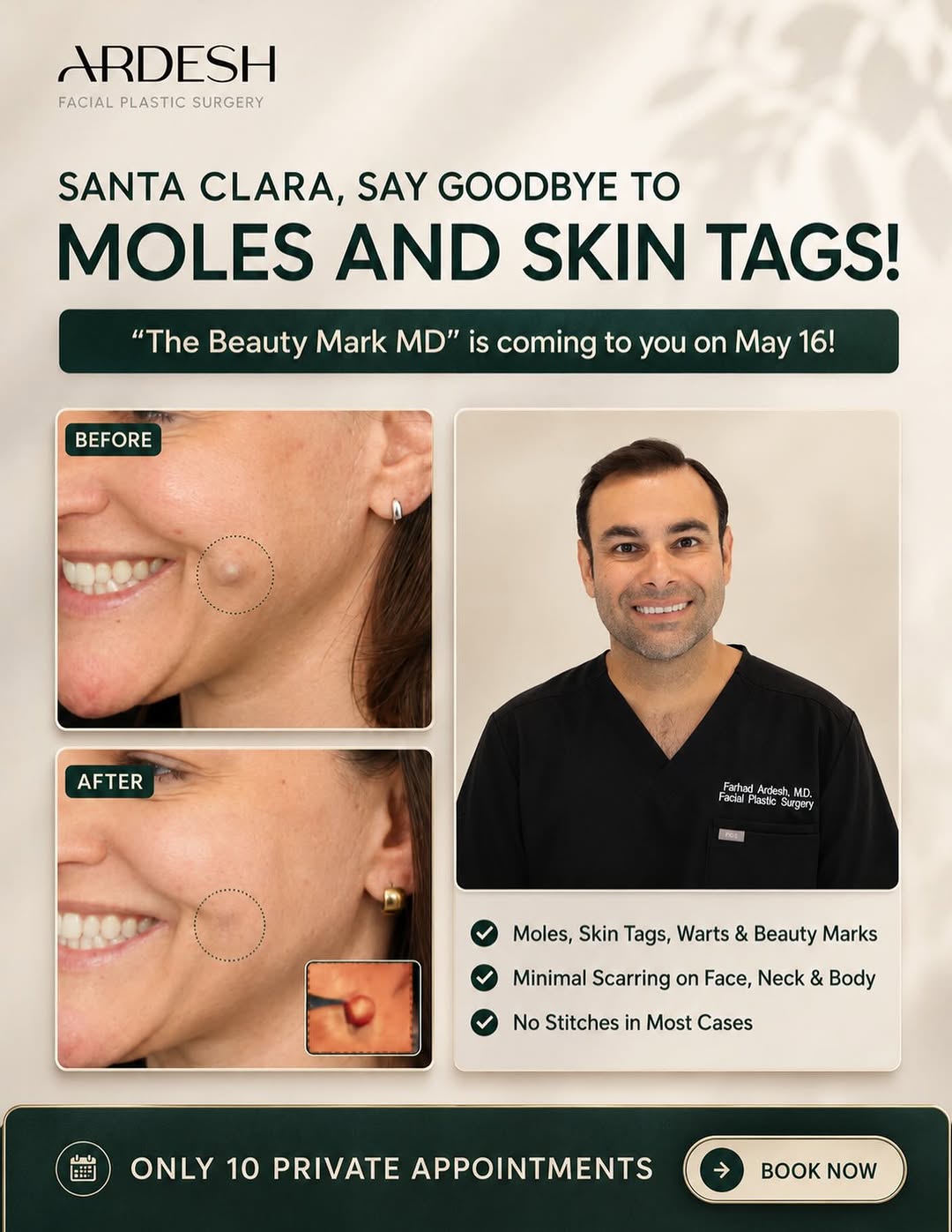 Instagram post by Dr. Farhad Ardesh: Dr. Ardesh is coming to Santa Clara on May 16 for a limited number of private appointments. ✔ Minimal scarring ✔ No stitches in most cases ✔…