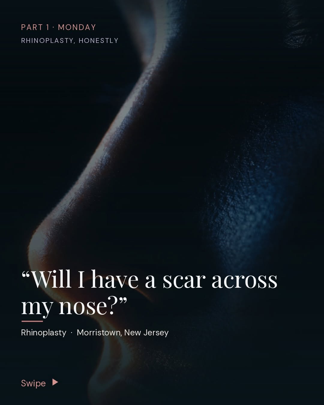 Instagram post by Dr. Farhad Rafizadeh: “Will I have a scar across my nose?” — the first thing almost everyone asks. Honest answer: probably not one you’ll ever notice. A closed rh…