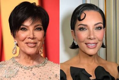 Instagram post by Dr. Farrokh Shafaie: Happy Monday, Instagram family ❤️ Today we’re taking a closer look at another recent, jaw-dropping celebrity before and after - Kris Jenner✨…
