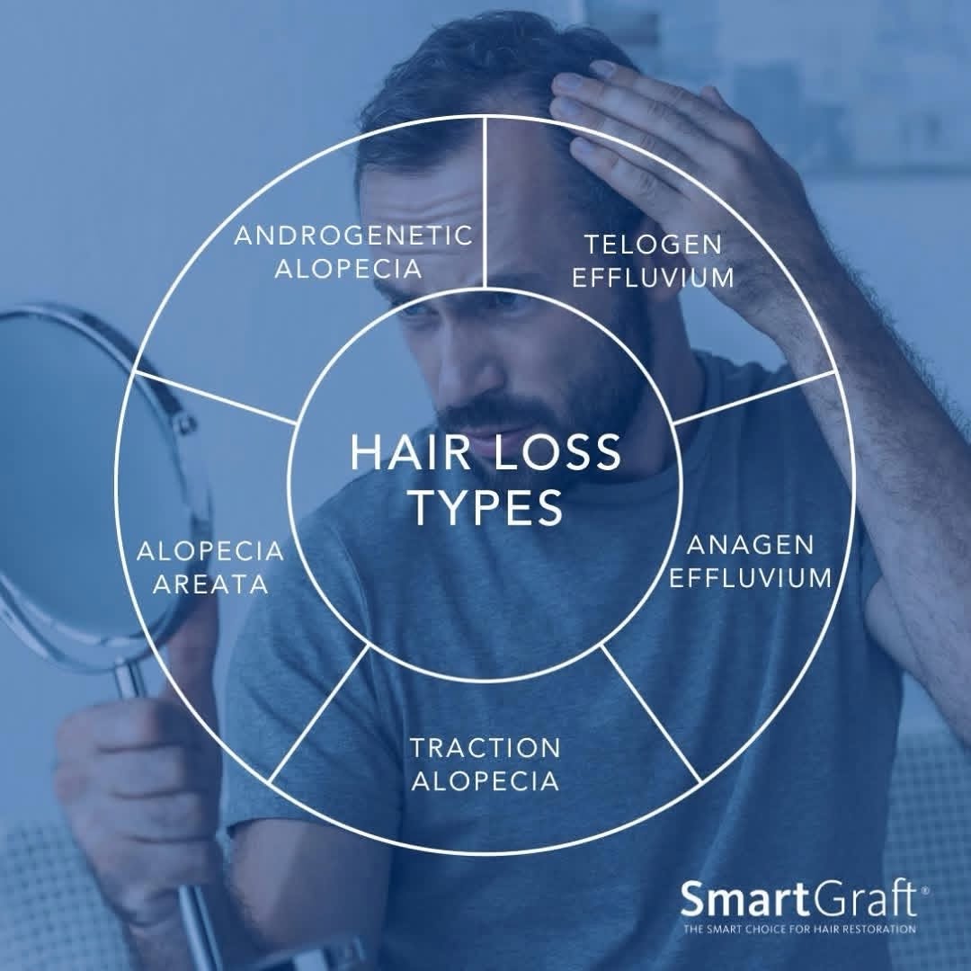 Instagram post by Dr. Francis J. Collini: Hair Loss Isn’t One-Size-Fits-All. Not all hair loss has the same cause—and understanding why you’re losing hair is the first step toward fi…