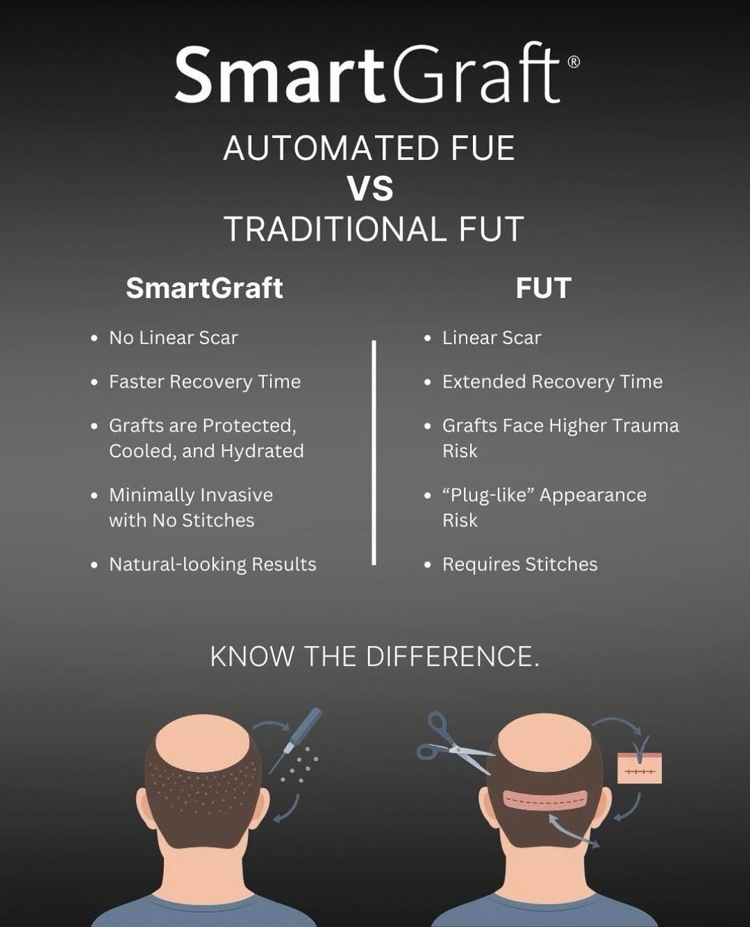 Instagram post by Dr. Francis J. Collini: ✨ Thinking About Hair Restoration? Know Your Options. Hair restoration doesn’t have to mean a linear scar or lengthy recovery. SmartGraft® A…