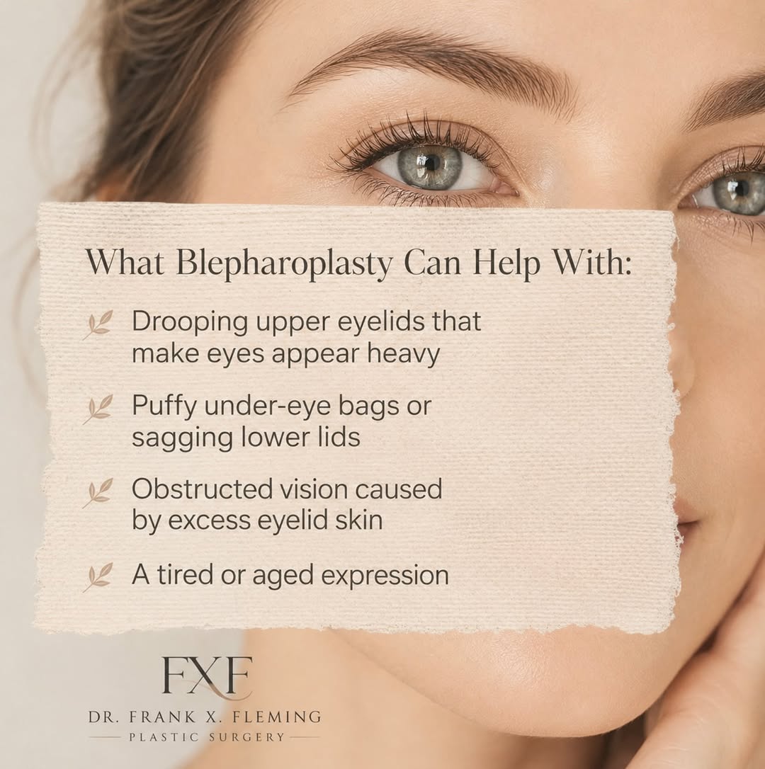 Instagram post by Dr. Francis X. Fleming: If you are tired of having tired eyes, it might be time to schedule a consultation. Please call us at 509-412-0108, when you are ready to ha…