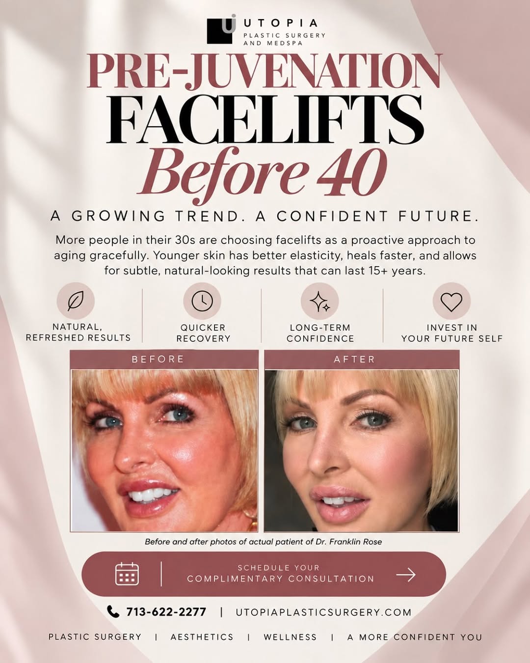 Instagram post by Dr. Franklin A. Rose: Pre-juvenation is changing the conversation around facelifts. ✨ More patients in their 30s are taking a proactive approach to aging, choosin…