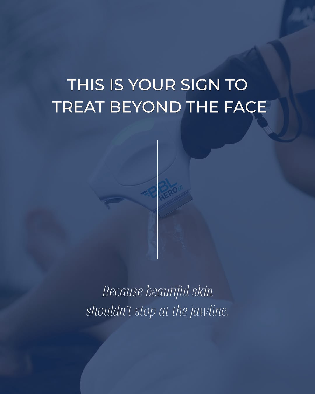 Instagram post by Dr. Fredric M. Barr: Laser and light treatments aren’t only for the face. Depending on the treatment, they can improve pigmentation, redness, uneven tone, textur…