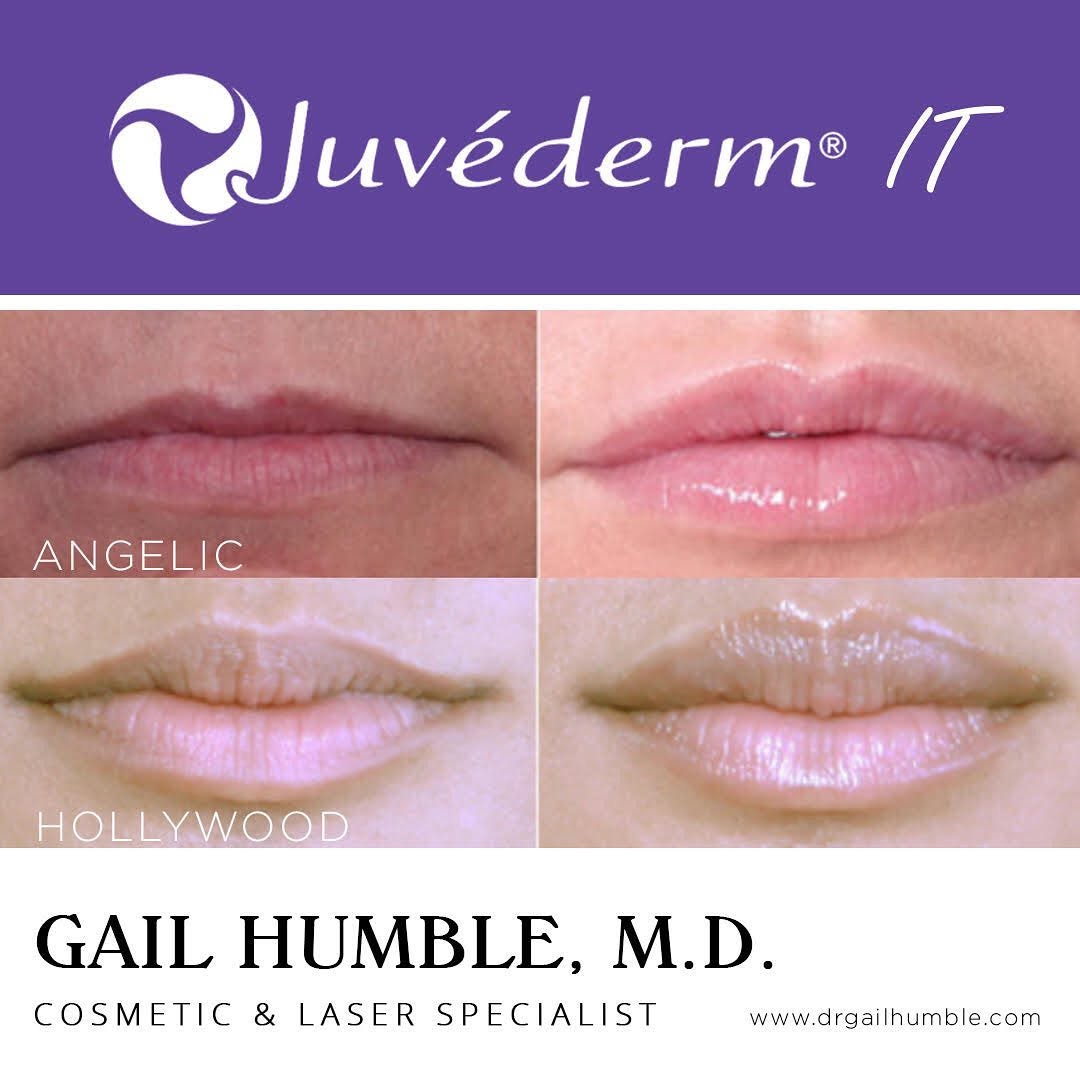 Instagram post by Dr. Gail Humble: The architecture of the lip is very important with respect to the entire face. Lip architecture involved volume shape and balance with the r…