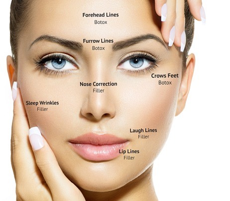 Instagram post by Dr. Garey Simmonds: Are you using #nofilter yet? Erase those forehead lines and crows feet with a little Botox,Juvederm, or Voluma. Make your appointment today …