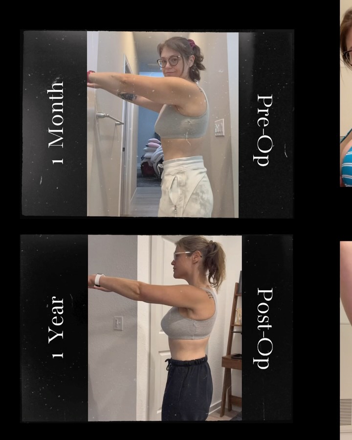 Instagram post by Dr. Gavin M. Dry: This freedom feels like the final piece of my 165-pound weight loss journey. The part that helped close one chapter and let a new one begin.…
