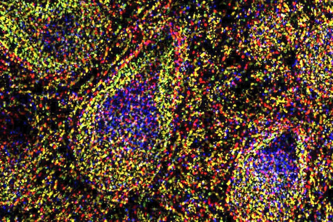 Instagram post by Dr. Gedge David Rosson: Repost from @jhm.fundamentals ... @HopkinsMedicine and @Hopkinsengineer scientists have developed a technology that allows them to capture a…