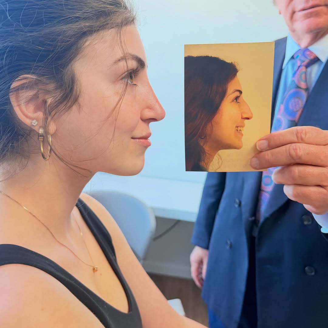 Instagram post by Dr. Geoffrey W. Tobias: One month post rhinoplasty, and healing beautifully. 🤍 This is the artistry of precision rhinoplasty: subtle refinement, natural results, a…