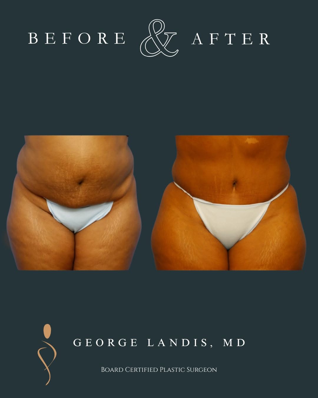 Instagram post by Dr. George H. Landis: ✨ Transformation that goes beyond the surface ✨ This beautiful patient came to us hoping to feel more comfortable in her own skin—and the re…