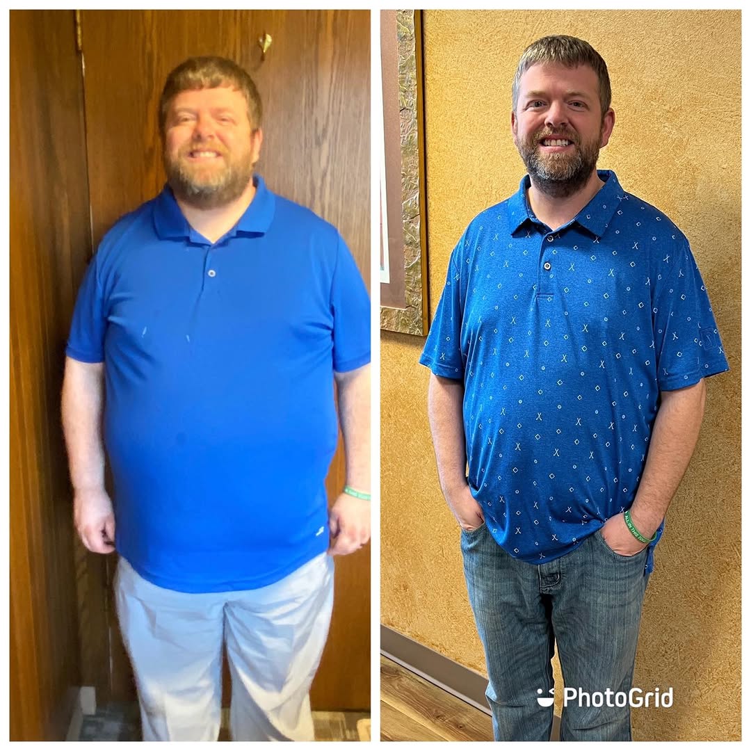 Instagram post by Dr. George R. Merriman II: Thanks for letting us share your success Mr C! Lap Band with Plication - 7 months post op- 102 pounds down. Way to work the program! Lap-Ban…