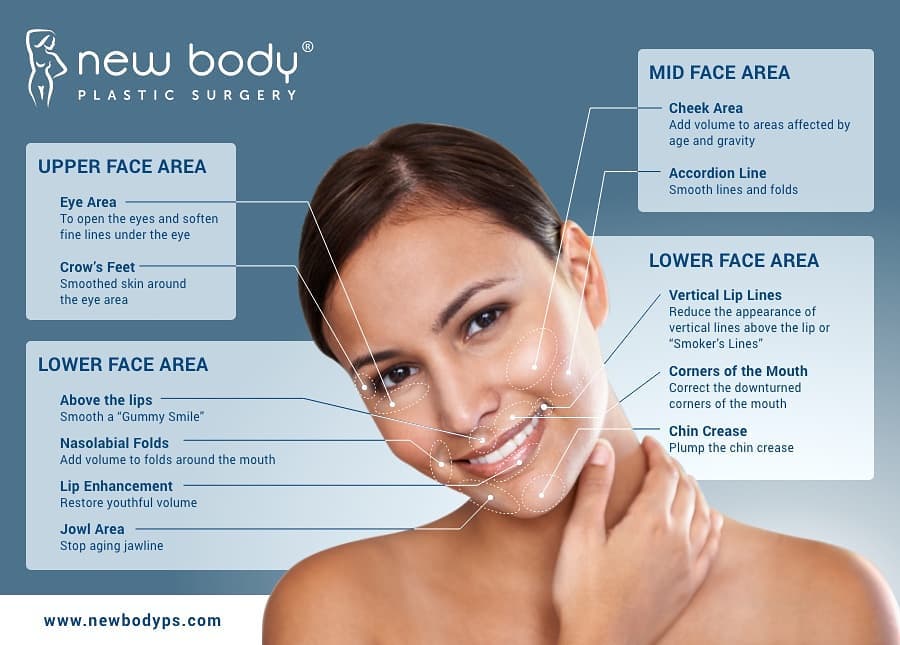 Instagram post by Dr. Georgios Ziakas: THAT GLOW THO! #NEWBODYPLASTICSURGERY _ For Boxed Warning and Medication Guide, see @botoxcosmeticpi. _ Visit NewBodyPS.com to find a specia…