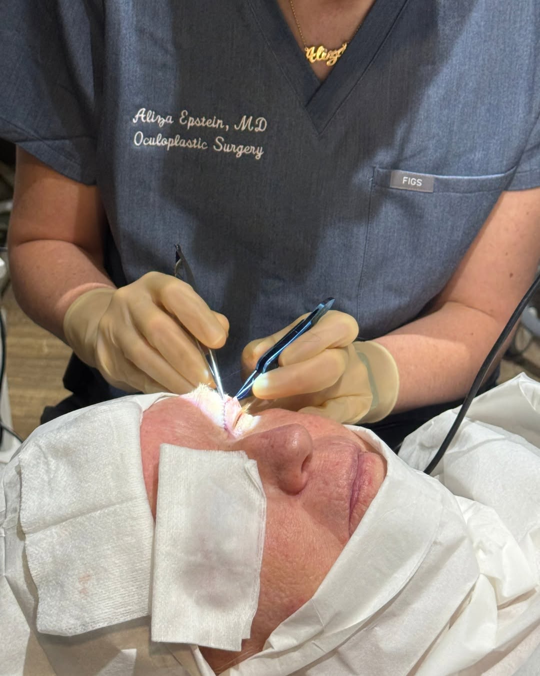 Instagram post by Dr. Gil A. Epstein: The details matter especially when we’re working around the eyes ✨ Eyelid surgery is a delicate balance of anatomy, function, and aesthetics…