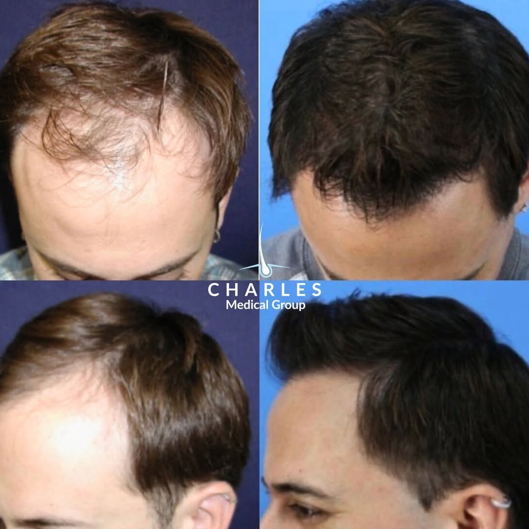 Instagram post by Dr. Glenn Charles: Patient results are what we're here for ✨👏 ㅤ Learn more about how Dr. Charles can help you achieve natural, lasting results at charlesmedic…