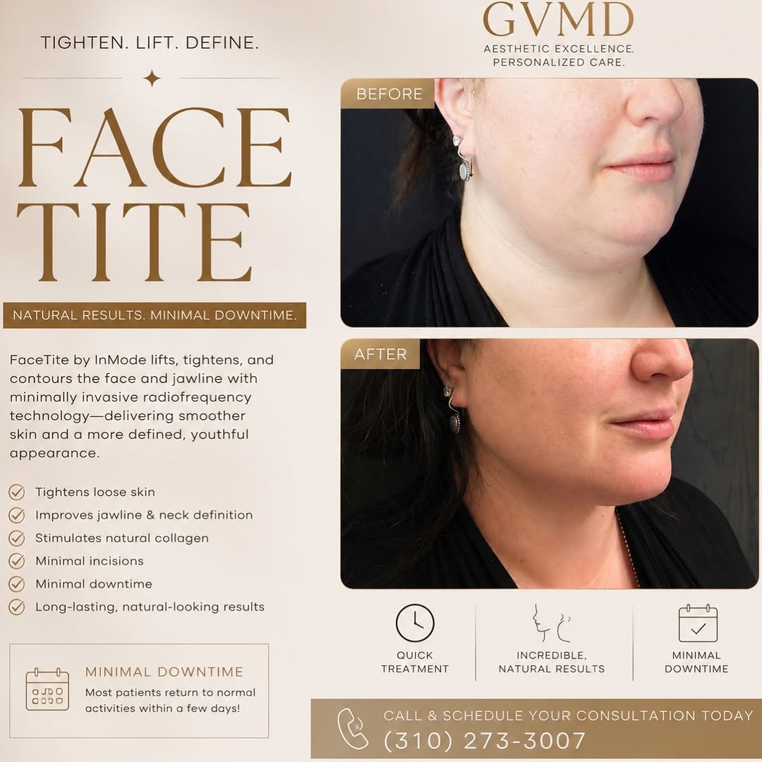 Instagram post by Dr. Glenn Vallecillos: Define your jawline. Tighten your skin. Refresh your confidence. ✨ FaceTite by InMode offers powerful facial contouring and skin tightening …