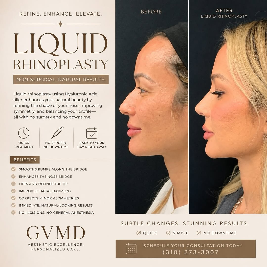 Instagram post by Dr. Glenn Vallecillos: ✨ Refine Your Profile, Without Surgery ✨ Our Liquid Rhinoplasty, using Hyaluronic Acid filler is a quick, non-surgical treatment that enhanc…