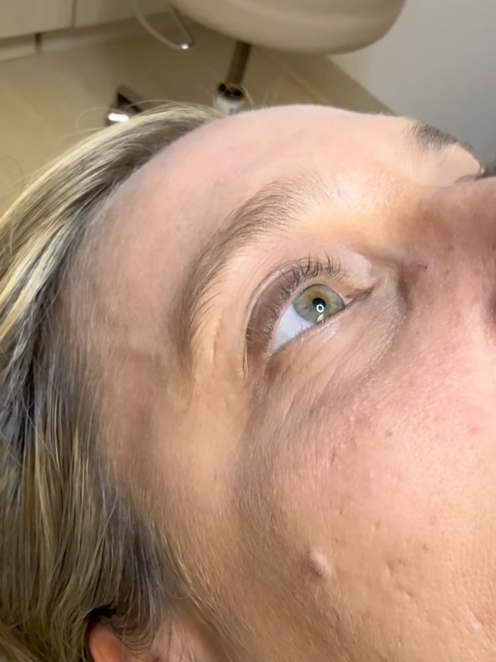 Instagram post by Dr. Gregory P. Kezele: A Lash Lift & Tint is the perfect way to be high-maintenance with minimal effort. This treatment enhances your natural lashes by lifting and…