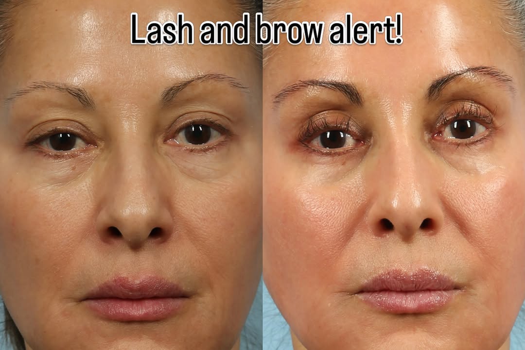 Instagram post by Dr. Gwen Maxwell: The secret behind those gorgeous lashes and fuller brows? RevitaLash Advanced and RevitaBrow Advanced condition and strengthen the hair, imp…