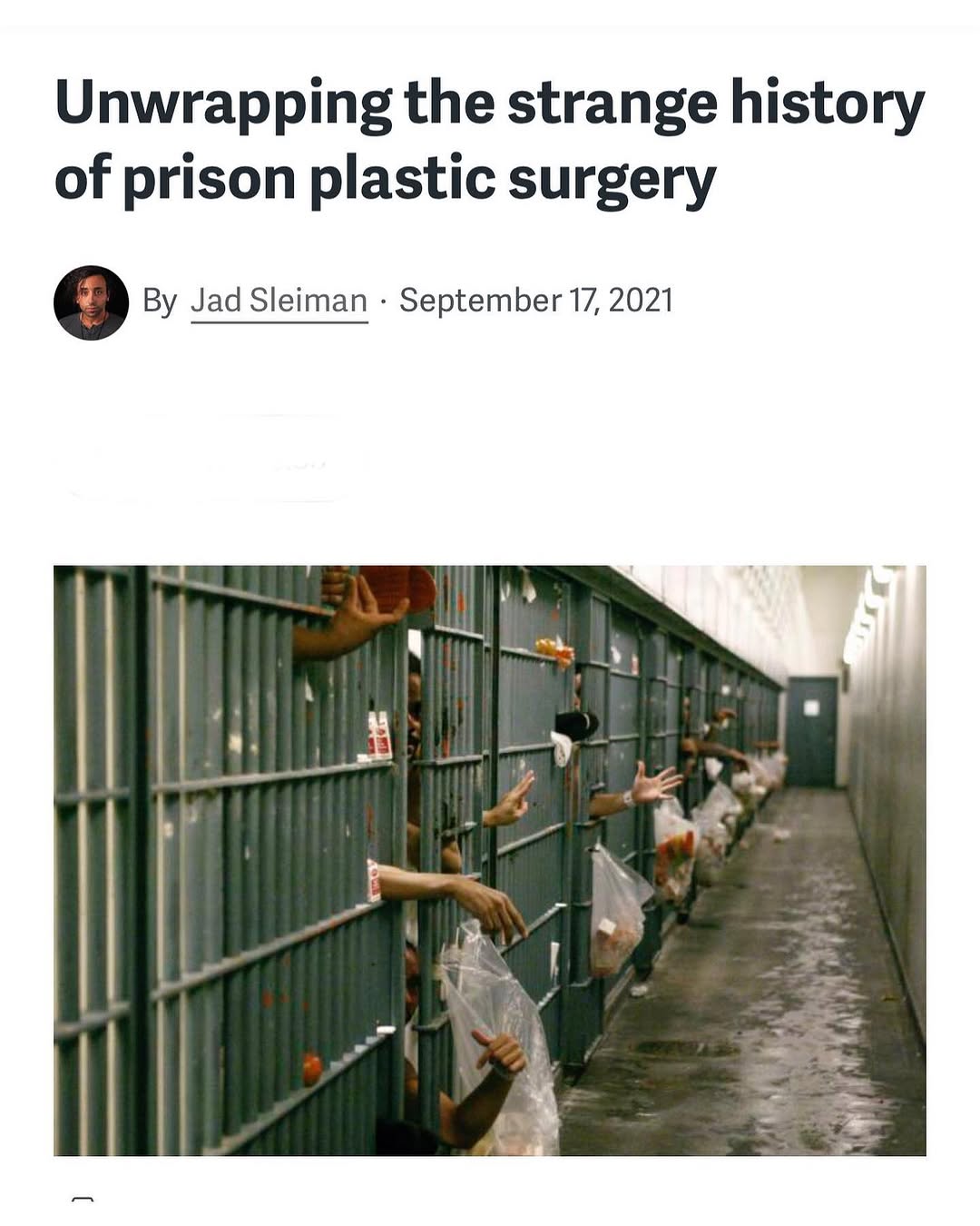 Instagram post by Dr. Harry Glassman: Interviewed by NPR about my project to reduce recidivism by performing surgery on inmates