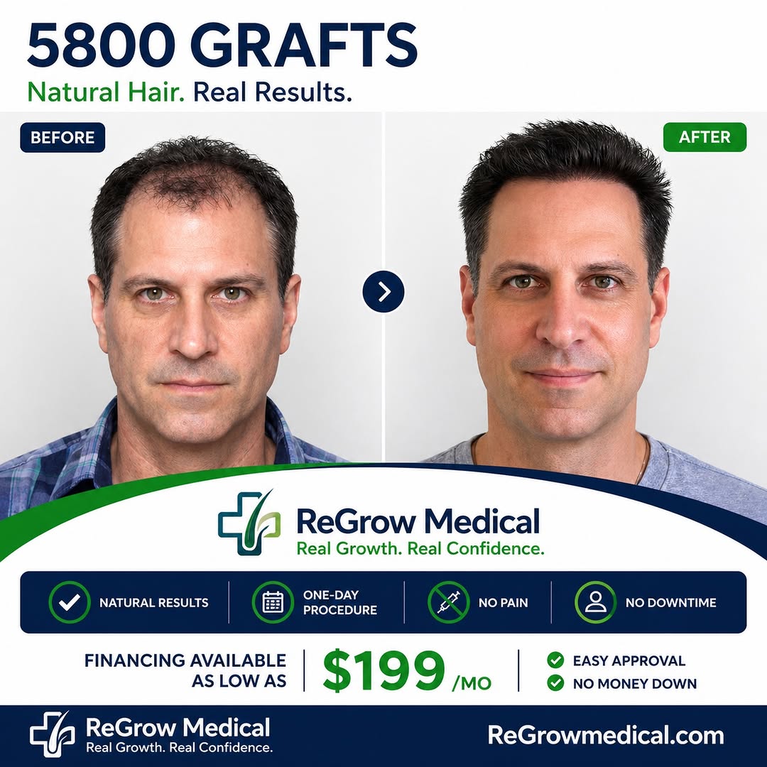 Instagram post by Dr. Heidi Regenass: 5,800 grafts. A major transformation designed to still look natural. 🌱 At ReGrow Medical, it’s not just about the number of grafts — it’s a…