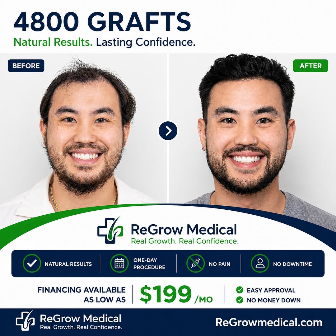 Instagram post by Dr. Heidi Regenass: 4,800 grafts. Natural results. Lasting confidence. 🌱 A successful hair transplant isn’t just about adding more hair — it’s about creating t…
