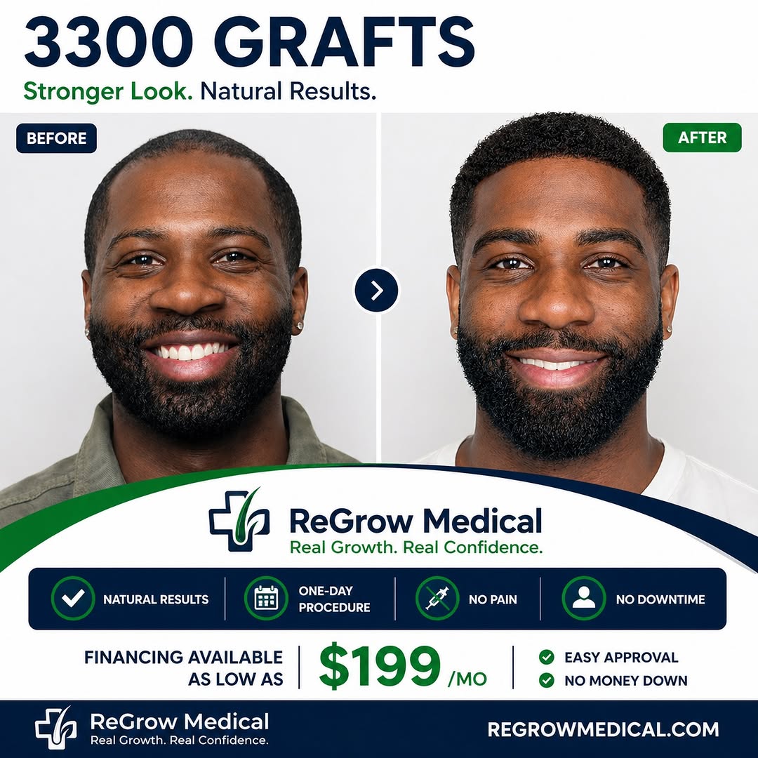 Instagram post by Dr. Heidi Regenass: 3,300 grafts. Stronger look. Natural results. 🌱 A great hair transplant should enhance your appearance without looking artificial. At **ReG…