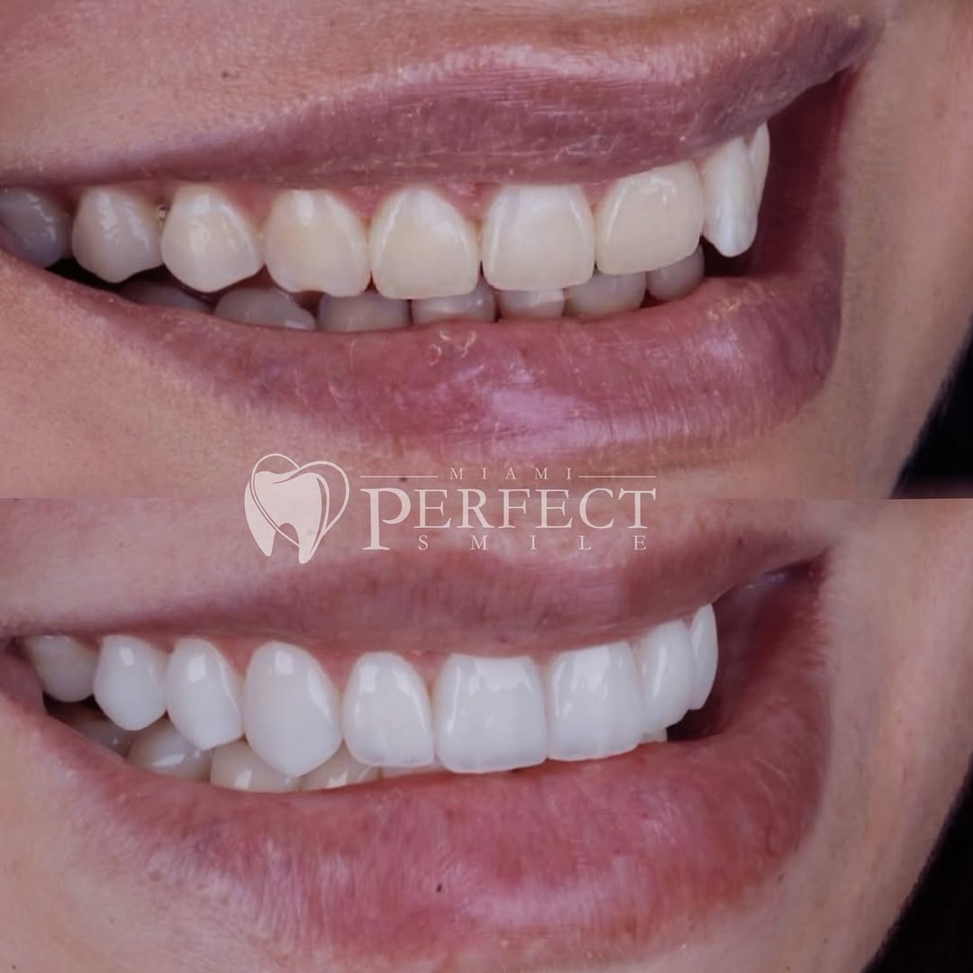 Instagram post by Dr. Helen Carmenate: ✨ ¡La sonrisa es una de las cosas más sagradas y especiales que tenemos! ✨ Si no te sientes completamente feliz con tu sonrisa, este puede s…
