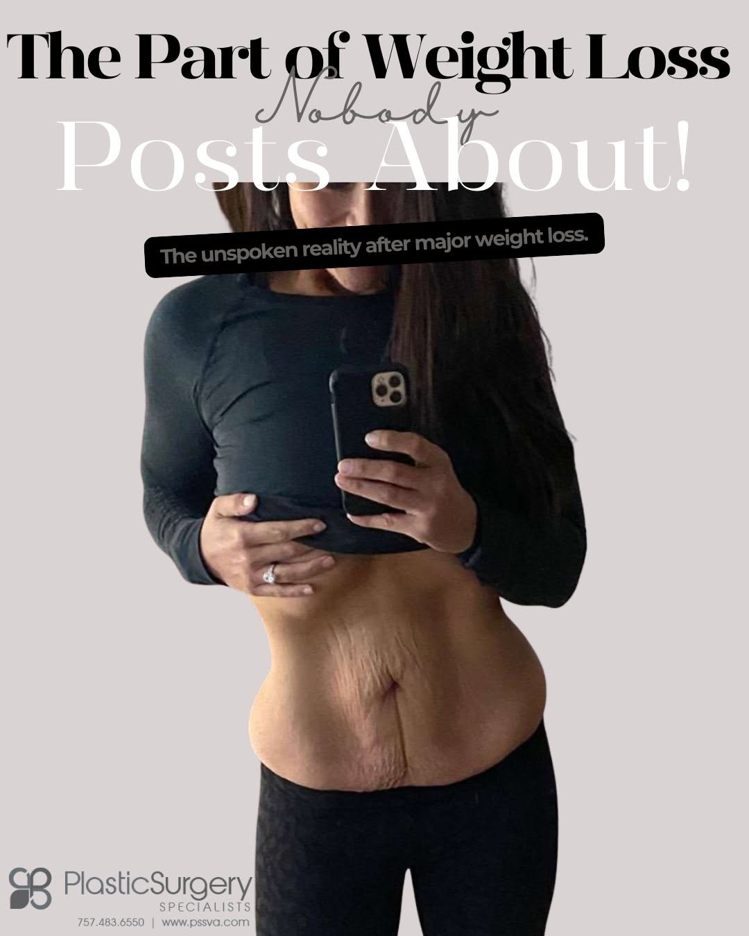 Instagram post by Dr. Helena Guarda: The part of weight loss nobody posts about. Before-and-after photos tell part of the story. They show the pounds you've lost. They don't sho…