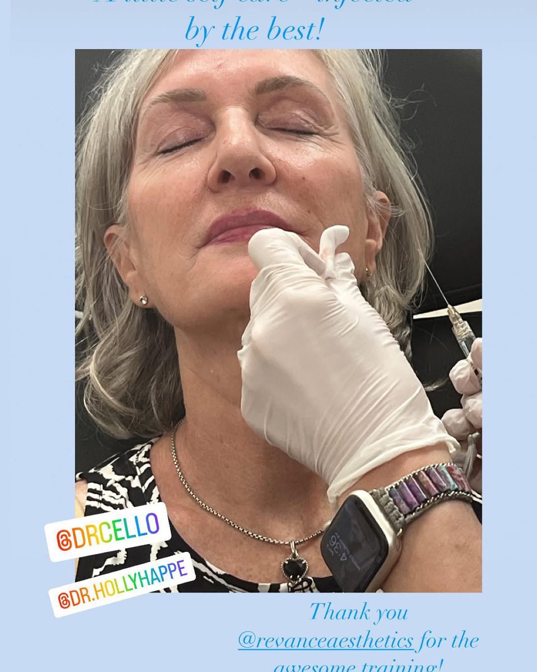 Instagram post by Dr. Holly Happe, DO: Great education this past Saturday from the incredibly knowledgeable @drcetto with many thanks to @katie_h_rivera @revanceaesthetics for spo…