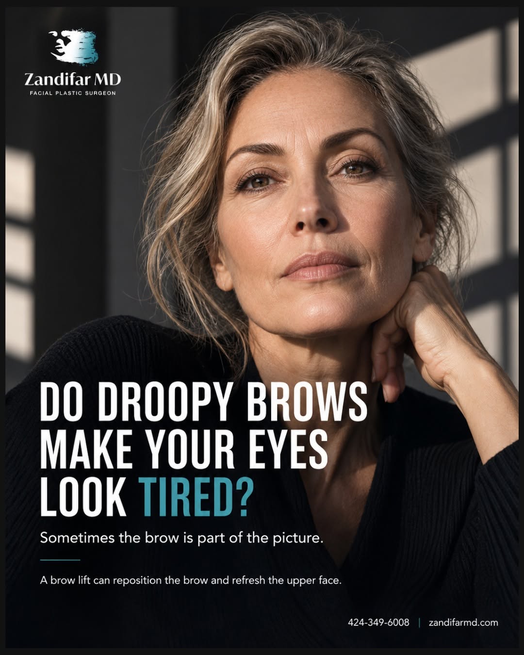 Instagram post by Dr. Hootan Zandifar: Do your eyes look tired even when you feel well-rested? As the brow naturally descends with age, it can contribute to a heavier appearance a…