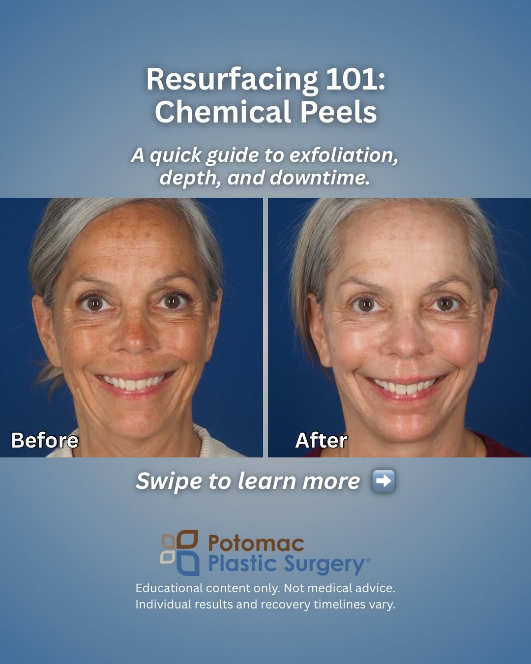 Instagram post by Dr. Houtan Chaboki: Chemical peels are one of the most effective ways to refresh dull skin, smooth out fine lines, and address sun damage—all without surgery. S…