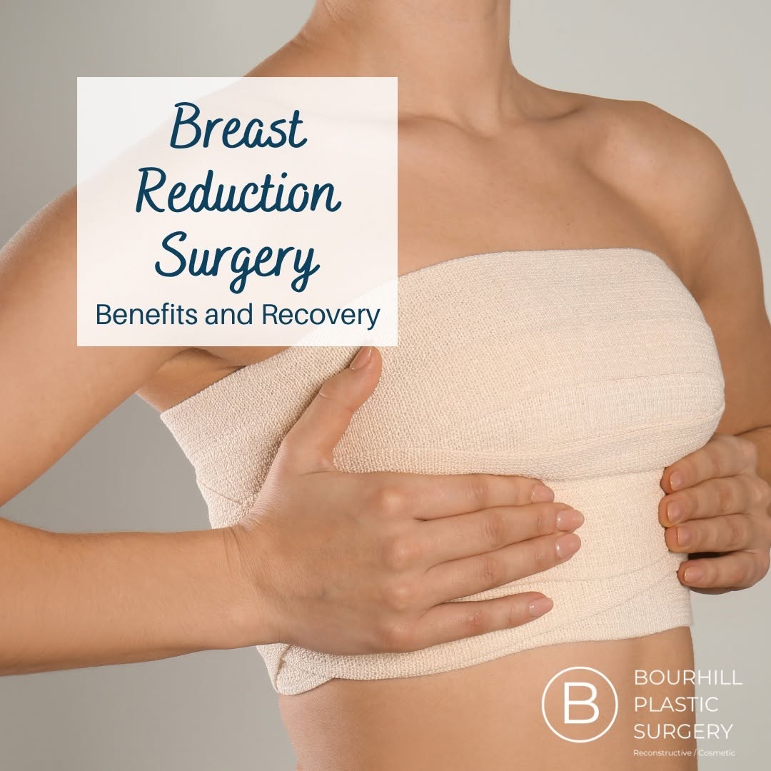 Instagram post by Dr. Ian L. Bourhill: A breast reduction at Bourhill Plastic Surgery offers transformative benefits that extend beyond physical relief. This procedure alleviates …